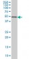 ETV5 Antibody (monoclonal) (M02)